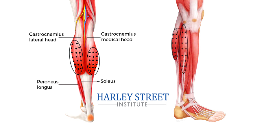 anatomy of leg