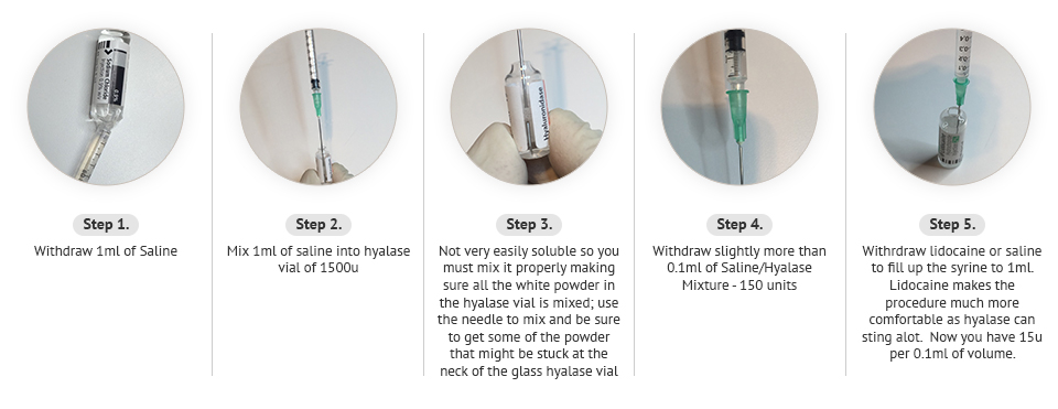 hyaluronidase aesthetics fillers drug its hyaluronic compared