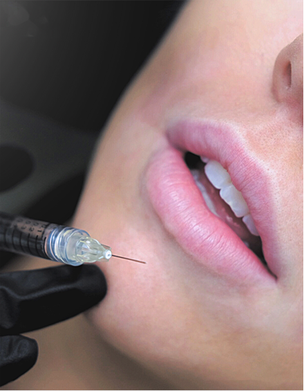 lip filler course